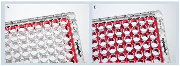 eppendorf