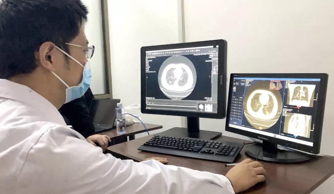 SenseCare-Lung Pro enables faster-automated diagnosis of lung diseases