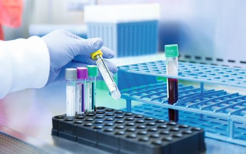 Health-economic analysis evaluates TB infection screening strategies among people living with HIV in Thailand