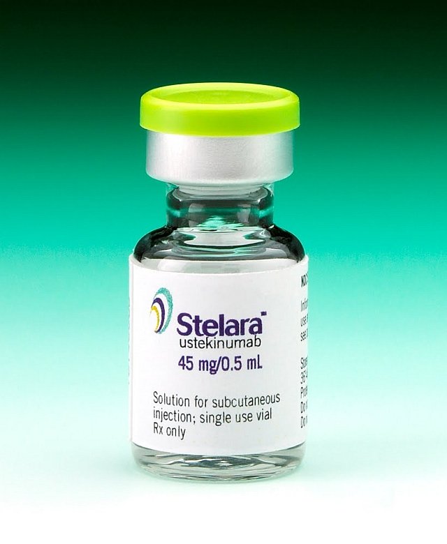 Centocor's STELARA improves conditions of patients with active psoriatic arthritis