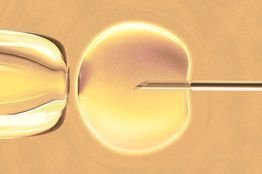 Genea Stem Cells (GSC) stem cell lines are placed on NIH registry