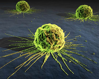 Hope for triple-negative breast cancer patients â€“ EntreMed preclinical study of ENMD-2076 gives positive results 