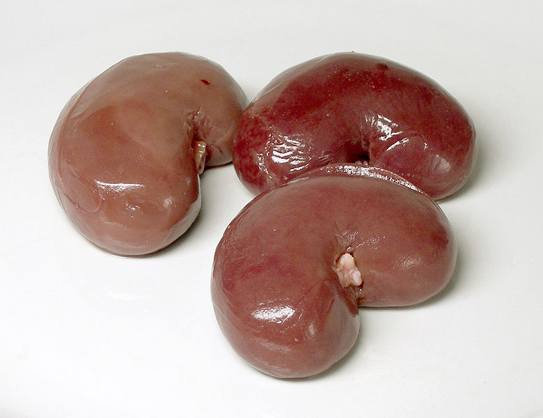Poor awareness of advanced kidney cancer in Singapore is a cause of concern for doctors