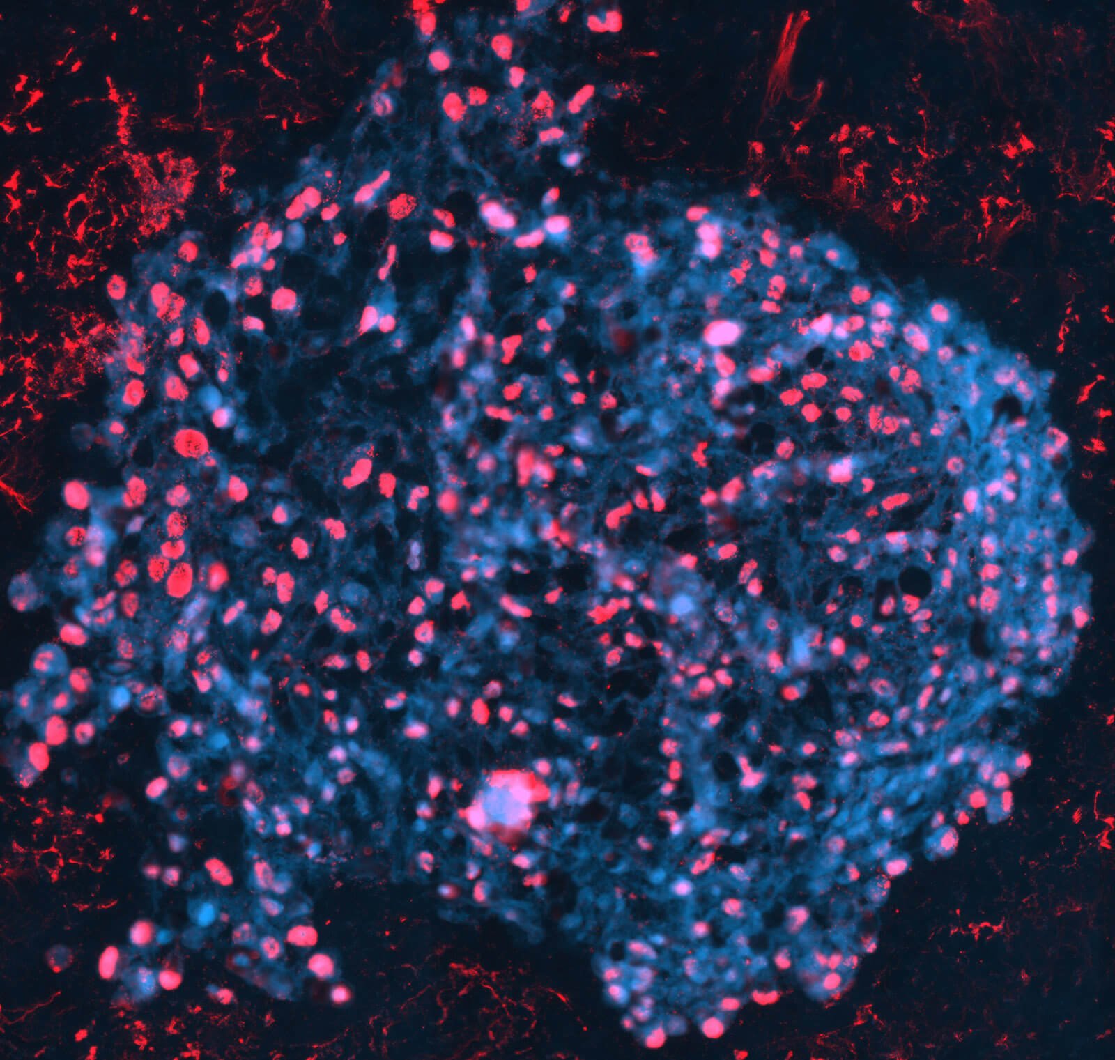 An image of a micro-tumor by NMI Natural and Medical Sciences Institute