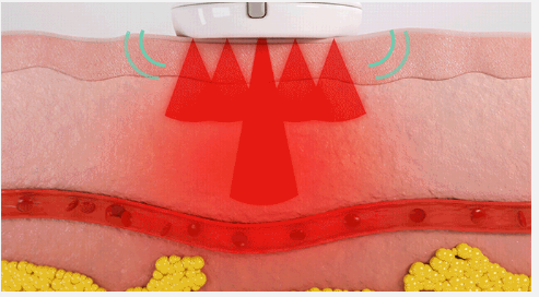 Image credit- wellscare.net