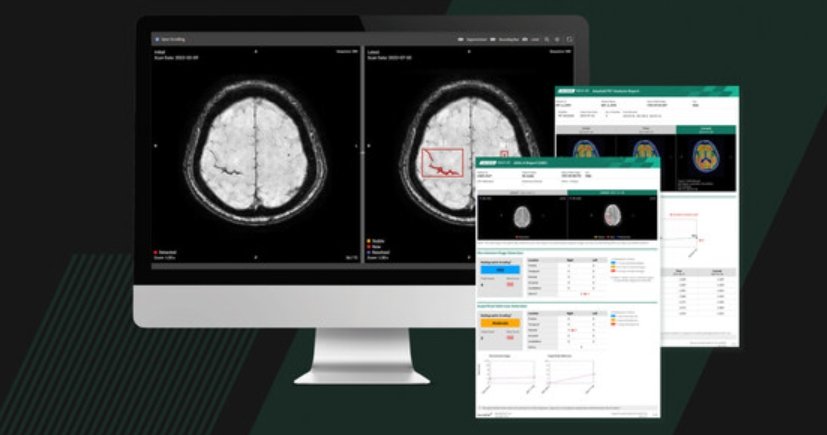 Korean startup Neurophet secures US FDA 510(k) clearance for neuroimaging analysis solution