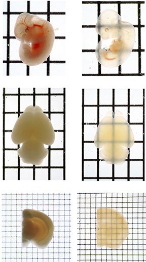 SeeDB is an inexpensive, quick, easy and safe way to make tissues transparent (Image source - RIKEN)