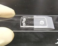 Technologies like the one used on the Veredus VereMTB (image) lab-on-chip device are revolutionizing the diagnostic industry