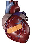 UCLA performs first transcatheter aortic valve replacement