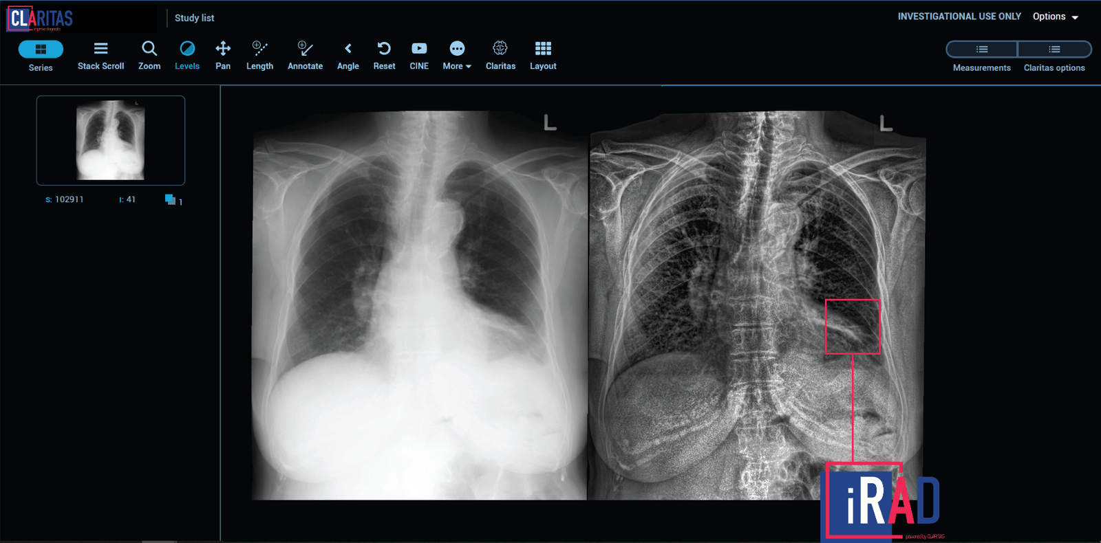 Image Caption: Claritas iRAD Platform